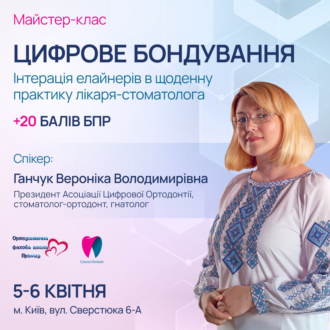 Цифровое бондирование