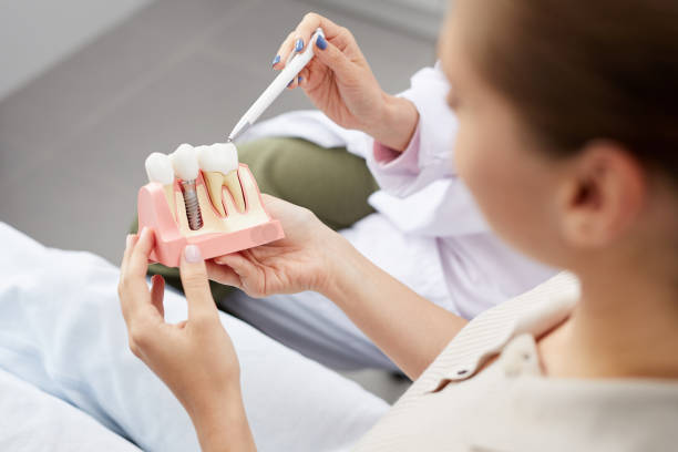 Імплантація зубів у Львові із гарантією якості у Giorno Dentale
