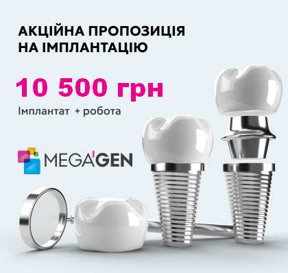 Імпланти Megagen за спеціальною ціною!