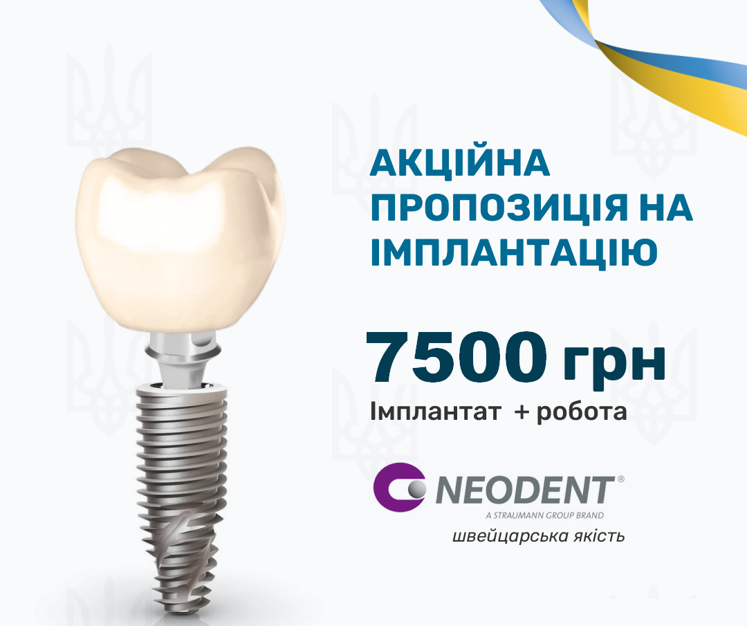 Імпланти Neodent за кращою ціною!