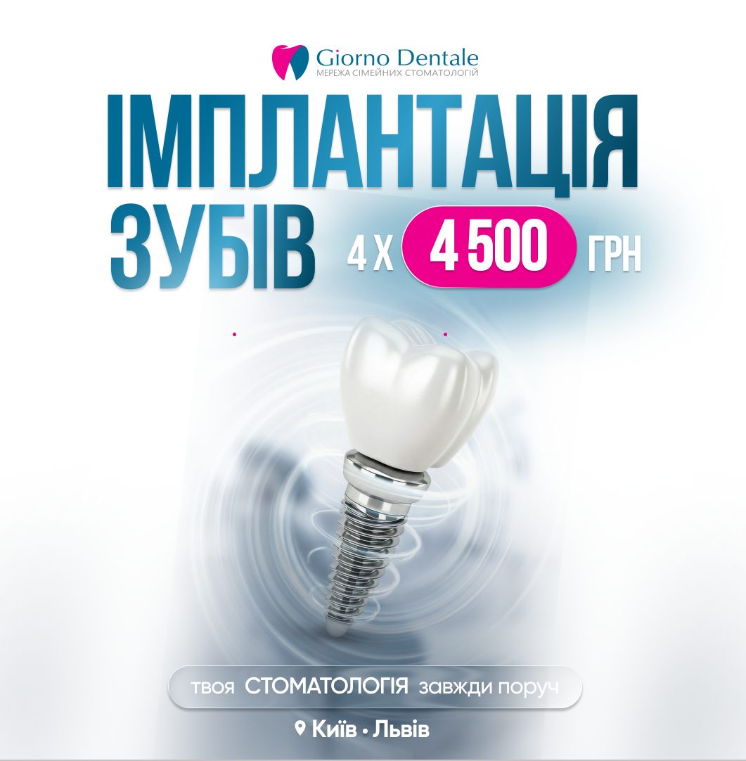 Імплантація зубів - доступна кожному!